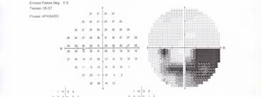 O 1apti0q8p1b9cgal6jo12bv1dqai